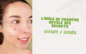 visage de femme avec problemes de peau